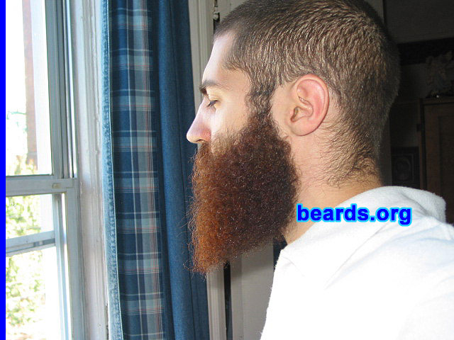 Dan
[b]Go to [url=http://www.beards.org/dan.php]Dan's success story[/url][/b].
Keywords: full_beard