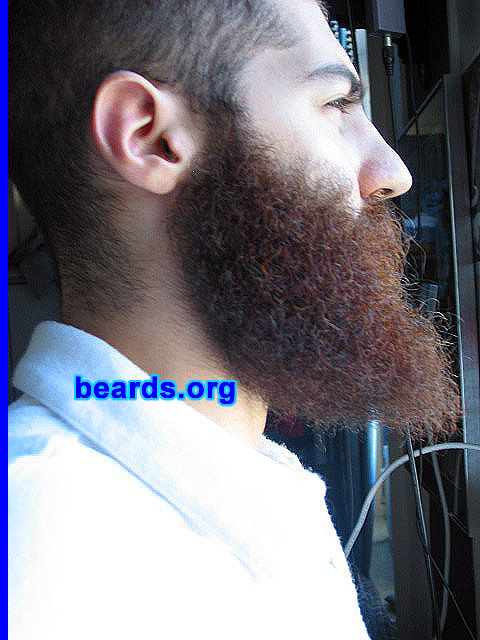 Dan
[b]Go to [url=http://www.beards.org/dan.php]Dan's success story[/url][/b].
Keywords: full_beard