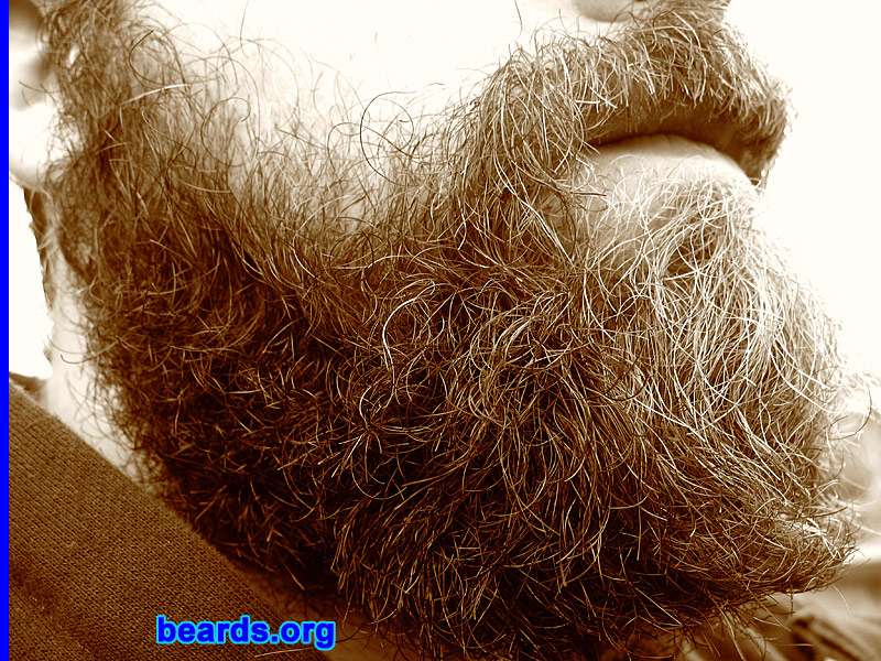 Dave
[b]Go to [url=http://www.beards.org/dave.php]Dave's success story[/url][/b].
Keywords: Dave.6 Dave_feature full_beard