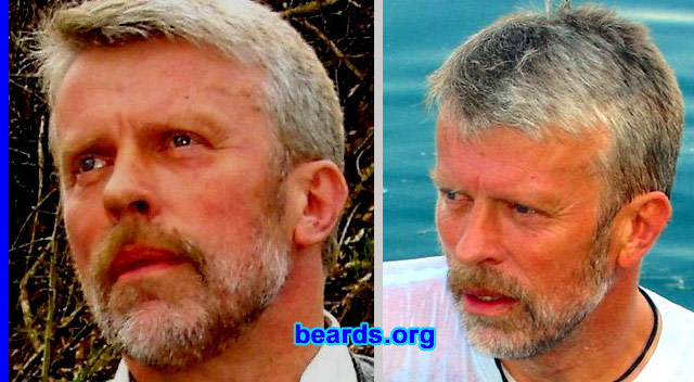 Dieter
Bearded since: 1980.  I am a dedicated, permanent beard grower.

Comments:
I grew my beard because I was tired of shaving and I like it.

How do I feel about my beard?  Could be more...but it's me.
Keywords: full_beard