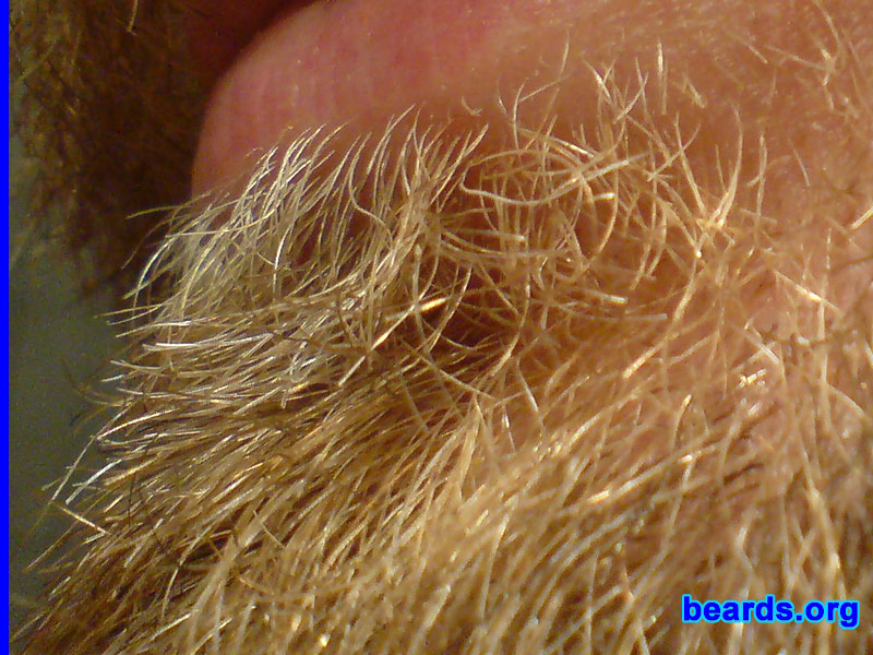 David
beard closeup

[b]Go to [url=http://www.beards.org/david.php]David's success story[/url][/b].
Keywords: dl.2006 macro full_beard