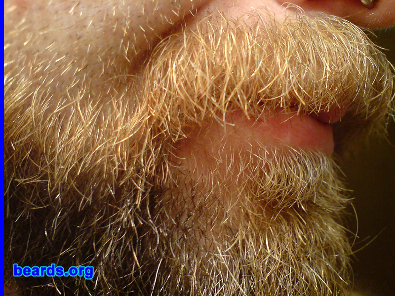 David
beard closeup

[b]Go to [url=http://www.beards.org/david.php]David's success story[/url][/b].
Keywords: dl.2006 macro full_beard