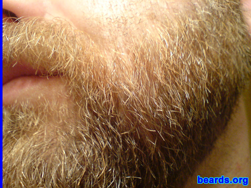 David
beard closeup

[b]Go to [url=http://www.beards.org/david.php]David's success story[/url][/b].
Keywords: dl.2006 macro full_beard
