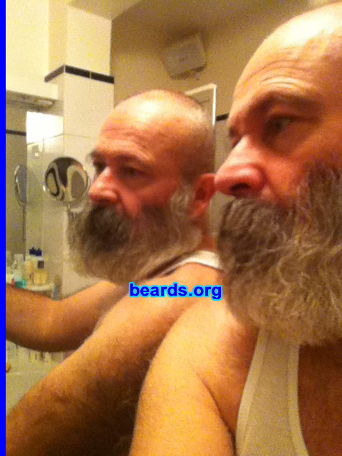 Berny
Bearded since: 1985. I am a dedicated, permanent beard grower.

Comments:
I grew my beard to feel better.

How do I feel about my beard?  So much better.
Keywords: full_beard