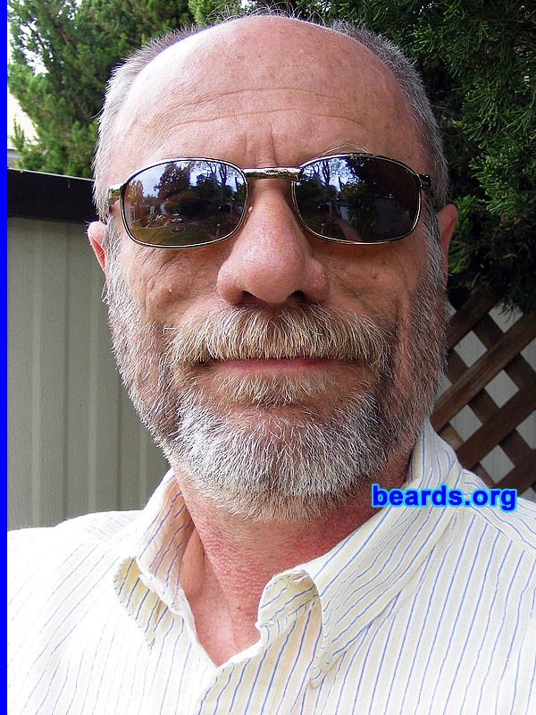 Glenn
[b]Go to [url=http://www.beards.org/success_glenn.php]Glenn's success story[/url][/b].
Keywords: full_beard