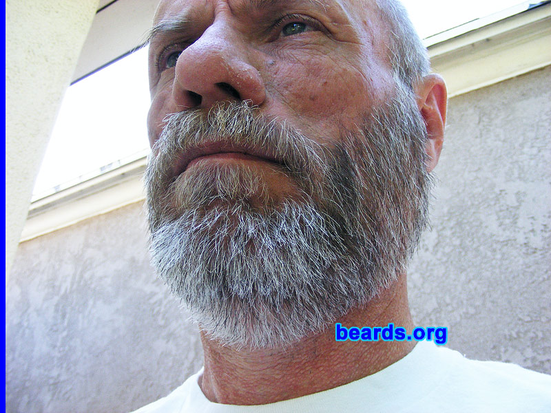 Glenn
[b]Go to [url=http://www.beards.org/success_glenn.php]Glenn's success story[/url][/b].
Keywords: full_beard