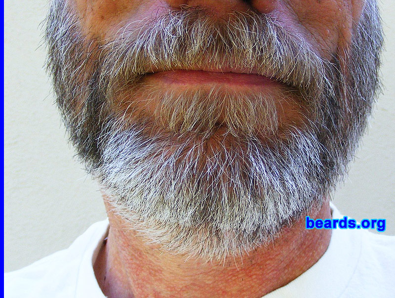 Glenn
[b]Go to [url=http://www.beards.org/success_glenn.php]Glenn's success story[/url][/b].
Keywords: full_beard