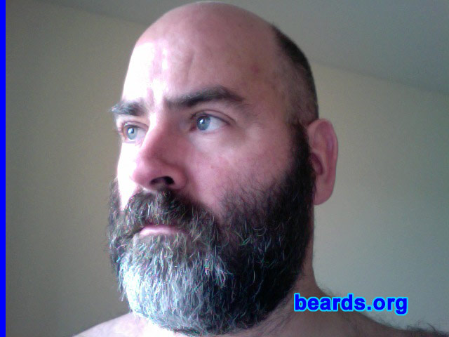 Patrick
Bearded since: 2007.  I am a dedicated, permanent beard grower.

Comments:
I grew my beard because it was cold in December 2006.

How do I feel about my beard? Fine.
Keywords: full_beard