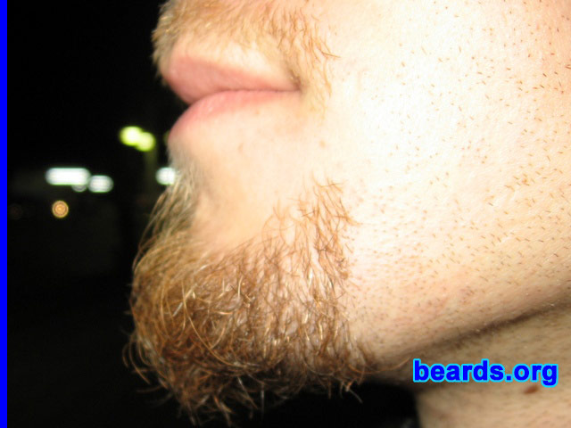 Max Zalevsky
Bearded since: 2005.  I am a dedicated, permanent beard grower.

Comments:
I grew my beard because of its indication for real men and... it's cool!

How do I feel about my beard?  I feel power.
Keywords: goatee_mustache