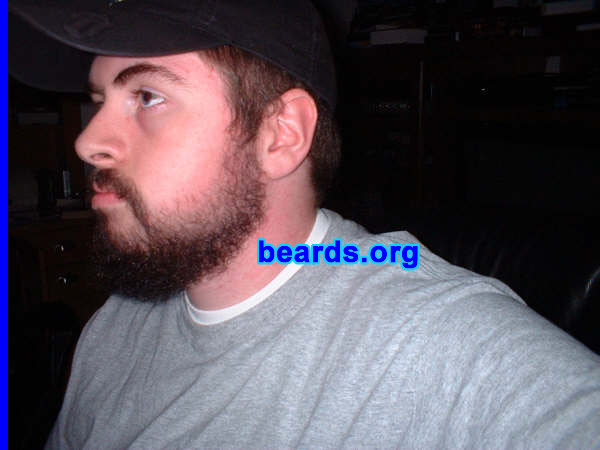 Kyle
[b]Go to [url=http://www.beards.org/kyle.php]Kyle's success story[/url][/b].
Keywords: full_beard