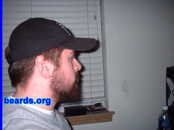 Kyle
[b]Go to [url=http://www.beards.org/kyle.php]Kyle's success story[/url][/b].
Keywords: full_beard