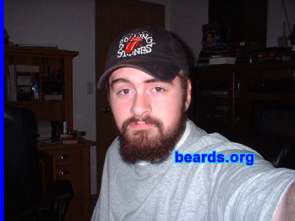 Kyle
[b]Go to [url=http://www.beards.org/kyle.php]Kyle's success story[/url][/b].
Keywords: full_beard