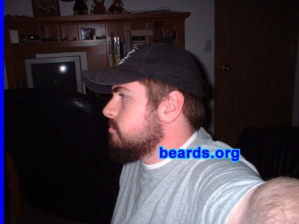 Kyle
[b]Go to [url=http://www.beards.org/kyle.php]Kyle's success story[/url][/b].
Keywords: full_beard