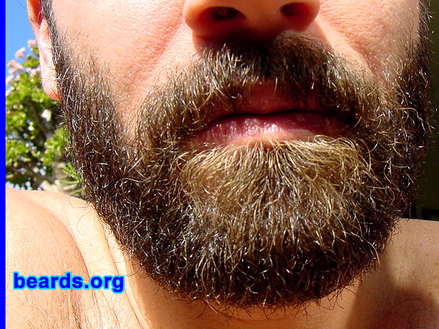 Linden
[b]Go to [url=http://www.beards.org/linden.php]Linden's success story[/url][/b].
Keywords: full_beard