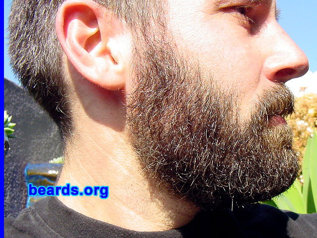 Linden
[b]Go to [url=http://www.beards.org/linden.php]Linden's success story[/url][/b].
Keywords: full_beard