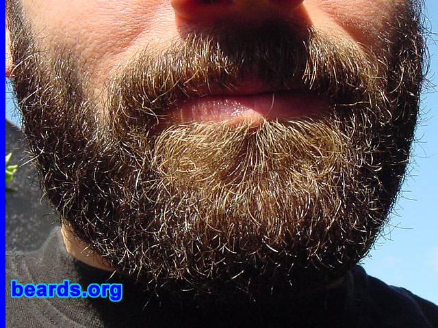 Linden
[b]Go to [url=http://www.beards.org/linden.php]Linden's success story[/url][/b].
Keywords: full_beard