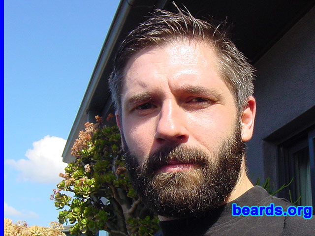 Linden
[b]Go to [url=http://www.beards.org/linden.php]Linden's success story[/url][/b].
Keywords: full_beard