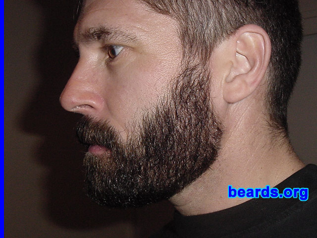 Linden
[b]Go to [url=http://www.beards.org/linden.php]Linden's success story[/url][/b].
Keywords: full_beard