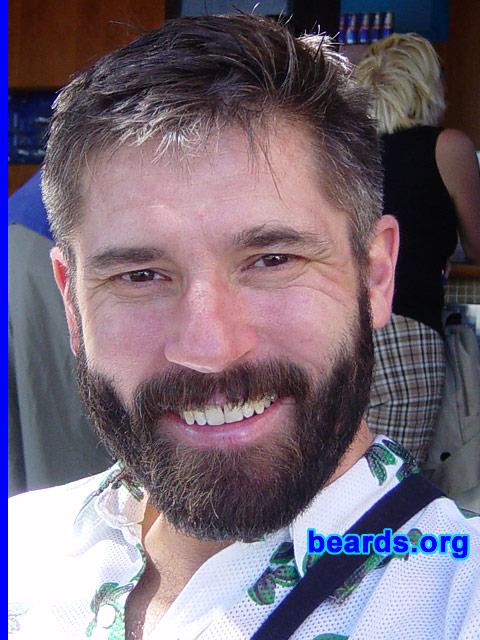 Linden
[b]Go to [url=http://www.beards.org/linden.php]Linden's success story[/url][/b].
Keywords: full_beard