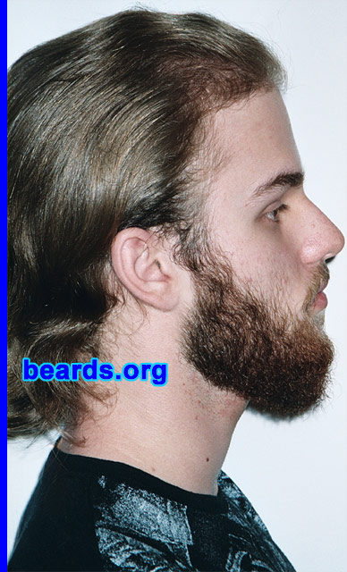 Michael
[b]Go to [url=http://www.beards.org/michael.php]Michael's success story[/url][/b].
Keywords: full_beard