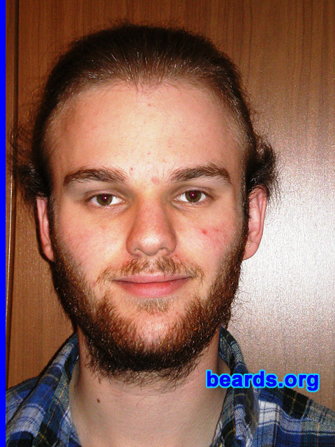 Michael
Update: March 2007.

[b]Go to [url=http://www.beards.org/michael.php]Michael's success story[/url][/b].
Keywords: full_beard