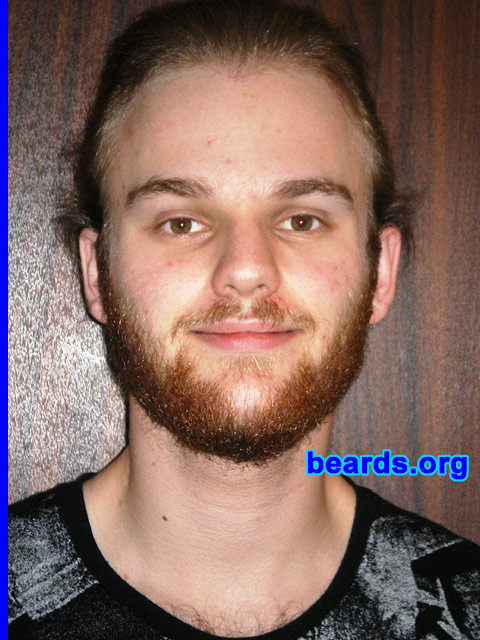 Michael
Update: March 2007.

[b]Go to [url=http://www.beards.org/michael.php]Michael's success story[/url][/b].
Keywords: full_beard