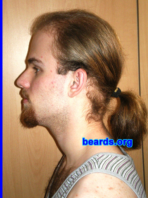 Michael
Update: April 2007.

[b]Go to [url=http://www.beards.org/michael.php]Michael's success story[/url][/b].
Keywords: goatee_mustache