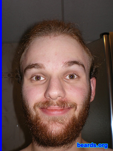 Michael
Update: July 2007.

[b]Go to [url=http://www.beards.org/michael.php]Michael's success story[/url][/b].
Keywords: full_beard