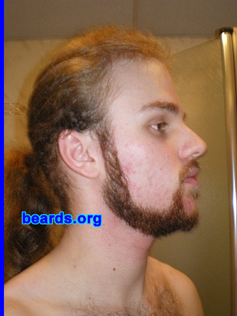 Michael
Update: July 2007.

[b]Go to [url=http://www.beards.org/michael.php]Michael's success story[/url][/b].
Keywords: full_beard