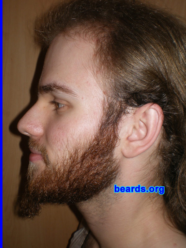 Michael
Update: October 2007.

[b]Go to [url=http://www.beards.org/michael.php]Michael's success story[/url][/b].
Keywords: full_beard