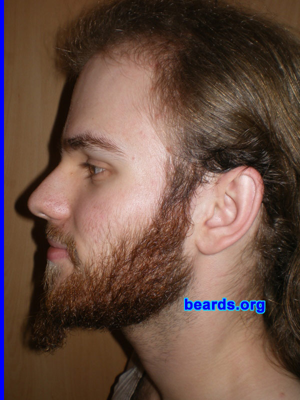 Michael
Update: October 2007.

[b]Go to [url=http://www.beards.org/michael.php]Michael's success story[/url][/b].
Keywords: full_beard