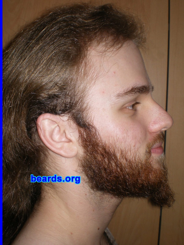 Michael
Update: October 2007.

[b]Go to [url=http://www.beards.org/michael.php]Michael's success story[/url][/b].
Keywords: full_beard