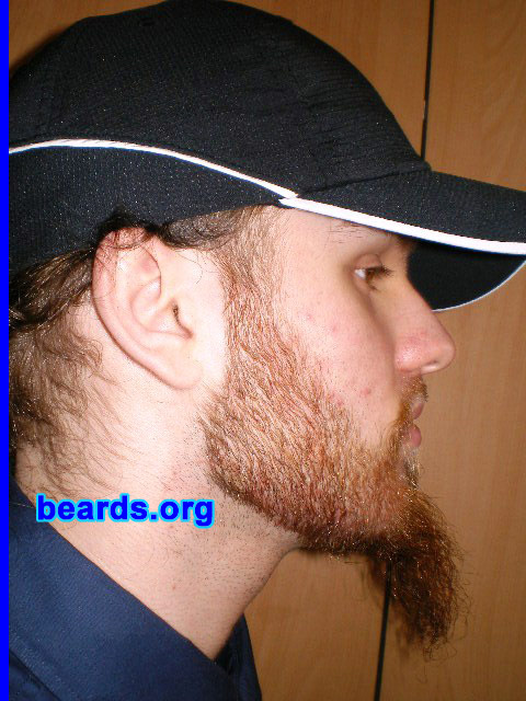 Michael
Update: January 2008.

[b]Go to [url=http://www.beards.org/michael.php]Michael's success story[/url][/b].
Keywords: full_beard