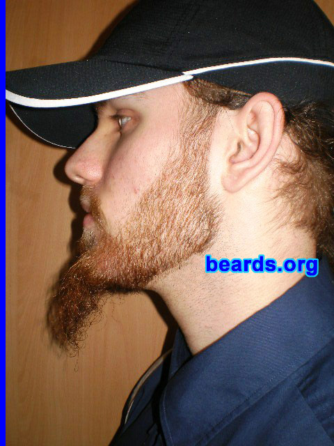 Michael
Update: January 2008.

[b]Go to [url=http://www.beards.org/michael.php]Michael's success story[/url][/b].
Keywords: full_beard