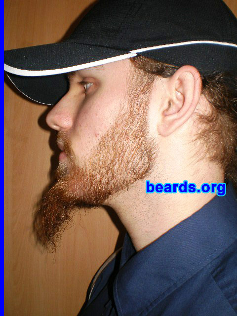 Michael
Update: January 2008.

[b]Go to [url=http://www.beards.org/michael.php]Michael's success story[/url][/b].
Keywords: full_beard