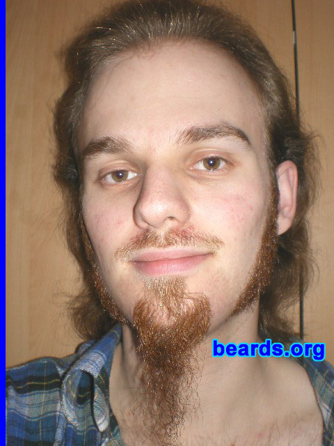 Michael
Update: March 2008

[b]Go to [url=http://www.beards.org/michael.php]Michael's success story[/url][/b].
Keywords: sideburns goatee_mustache