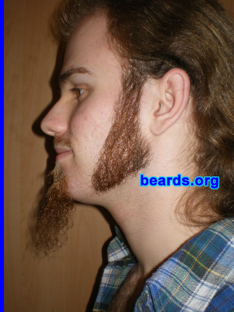 Michael
Update: March 2008

[b]Go to [url=http://www.beards.org/michael.php]Michael's success story[/url][/b].
Keywords: sideburns goatee_mustache