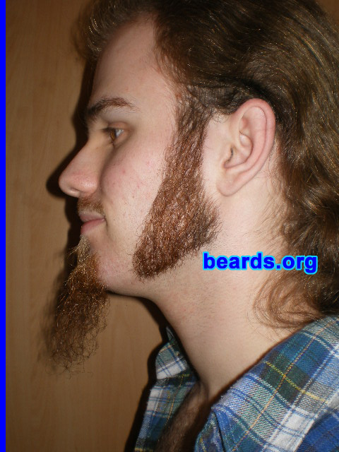 Michael
Update: March 2008

[b]Go to [url=http://www.beards.org/michael.php]Michael's success story[/url][/b].
Keywords: sideburns goatee_mustache