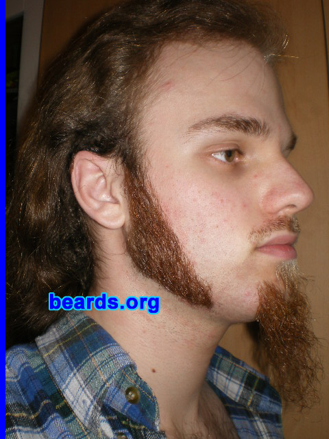 Michael
Update: March 2008

[b]Go to [url=http://www.beards.org/michael.php]Michael's success story[/url][/b].
Keywords: sideburns goatee_mustache