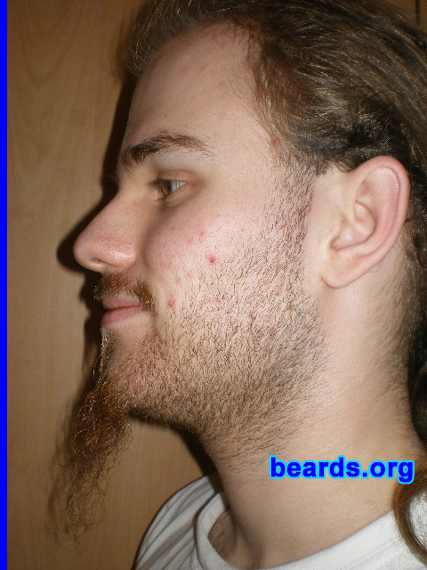 Michael
2008 growth series: day 7

[b]Go to [url=http://www.beards.org/michael.php]Michael's success story[/url][/b].
Keywords: michael_2008_series.1 full_beard
