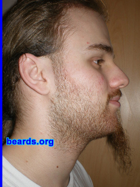 Michael
2008 growth series: day 7

[b]Go to [url=http://www.beards.org/michael.php]Michael's success story[/url][/b].
Keywords: michael_2008_series.1 full_beard