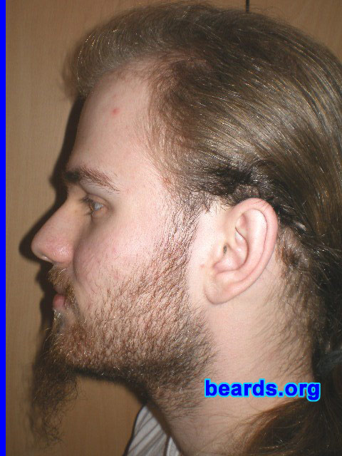 Michael
2008 growth series: day 14

[b]Go to [url=http://www.beards.org/michael.php]Michael's success story[/url][/b].
Keywords: michael_2008_series.1 full_beard