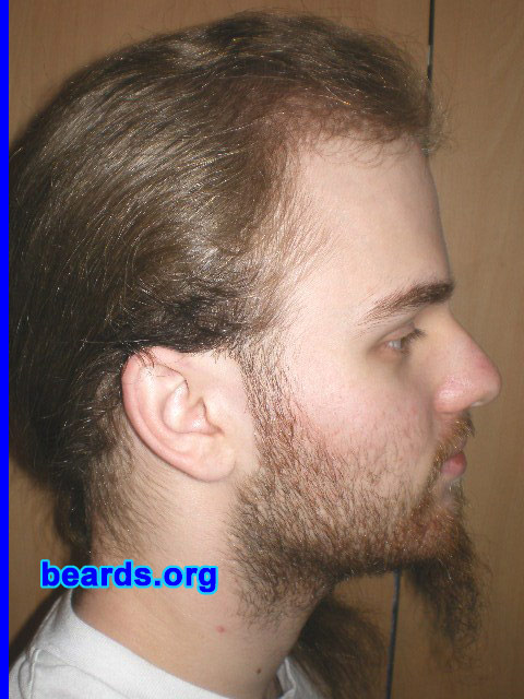 Michael
2008 growth series: day 14

[b]Go to [url=http://www.beards.org/michael.php]Michael's success story[/url][/b].
Keywords: michael_2008_series.1 full_beard