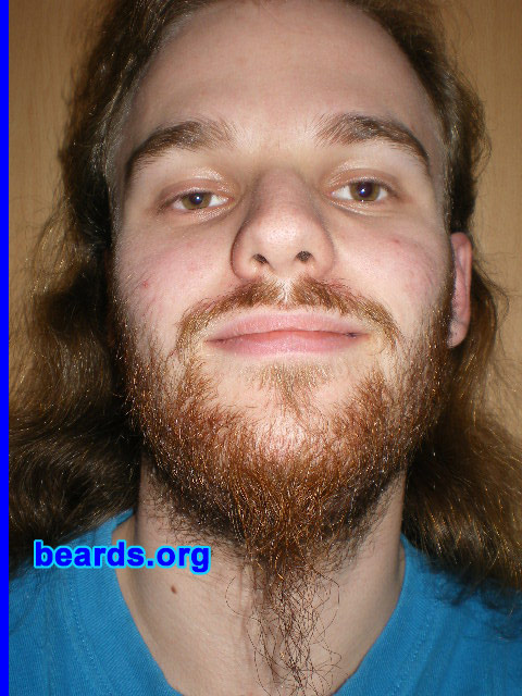 Michael
2008 growth series: day 21

[b]Go to [url=http://www.beards.org/michael.php]Michael's success story[/url][/b].
Keywords: michael_2008_series.1 full_beard