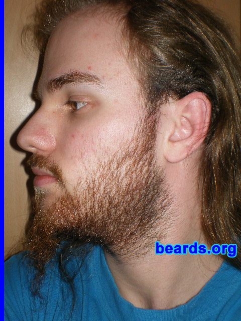 Michael
2008 growth series: day 21

[b]Go to [url=http://www.beards.org/michael.php]Michael's success story[/url][/b].
Keywords: michael_2008_series.1 full_beard