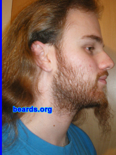 Michael
2008 growth series: day 21

[b]Go to [url=http://www.beards.org/michael.php]Michael's success story[/url][/b].
Keywords: michael_2008_series.1 full_beard