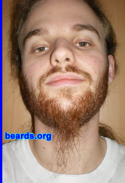 Michael
2008 growth series: day 28

[b]Go to [url=http://www.beards.org/michael.php]Michael's success story[/url][/b].
Keywords: michael_2008_series.1 full_beard