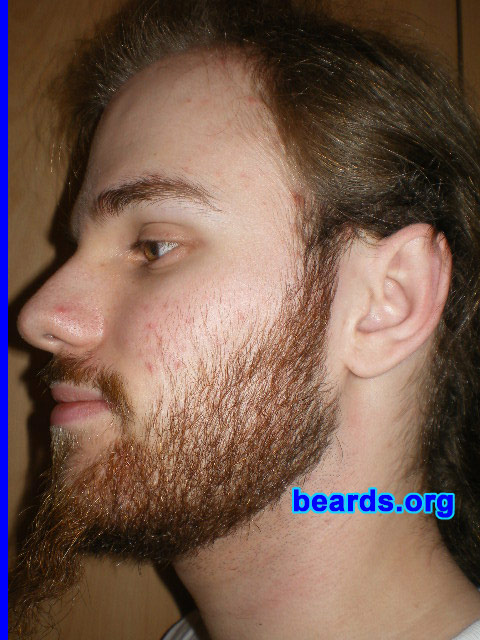 Michael
2008 growth series: day 28

[b]Go to [url=http://www.beards.org/michael.php]Michael's success story[/url][/b].
Keywords: michael_2008_series.1 full_beard