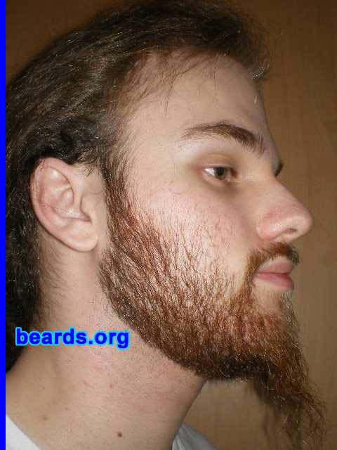 Michael
2008 growth series: day 28

[b]Go to [url=http://www.beards.org/michael.php]Michael's success story[/url][/b].
Keywords: michael_2008_series.1 full_beard