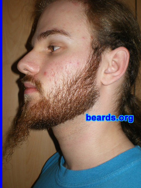 Michael
2008 growth series: day 35

[b]Go to [url=http://www.beards.org/michael.php]Michael's success story[/url][/b].
Keywords: michael_2008_series.1 full_beard